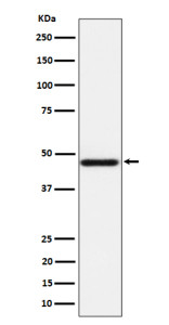 Anti-AZI2 / 5-Azacytidine-induced protein 2, clone 30A13