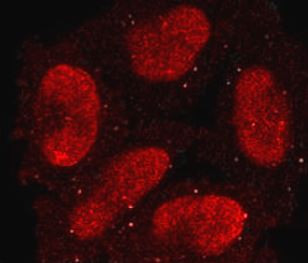 Anti-phospho-STAT3 (Tyr705)