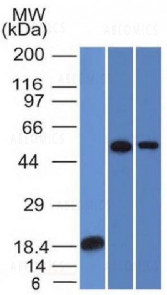 Anti-TOX3 / TNRC9 Monoclonal Antibody (Clone: TOX3/1124)