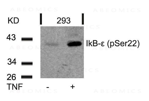 Anti-phospho-IkB-epsilon (Ser22)