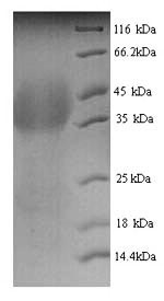 Lutropin-choriogonadotropic hormone receptor (LHCGR), partial, human, recombinant