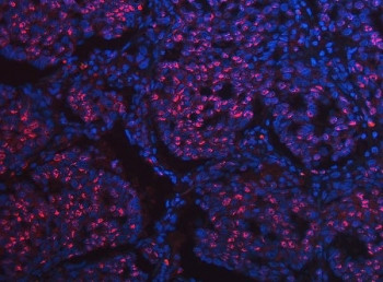 Anti-SCML1