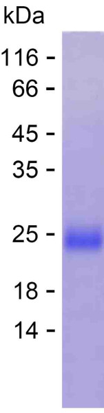 Recombinant Human TCTN1 Protein