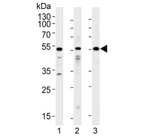 Anti-ACVR1 / ALK2