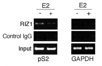 Anti-RIZ1, clone 33AT1045