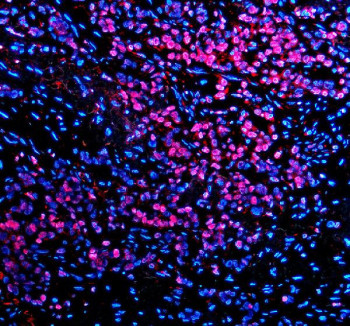Anti-TBX5 / T-box protein 5