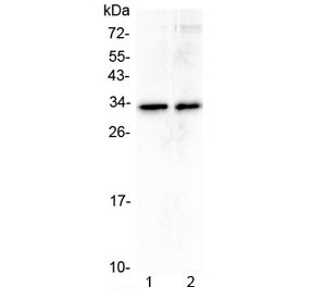 Anti-MED6 / ARC33