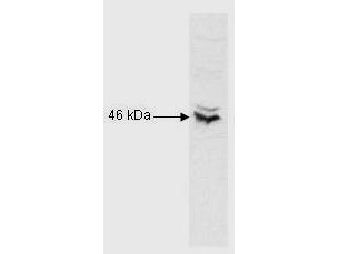 Anti-RFX5, NT (Regulatory Factor X5)