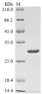 Putative hydrolase RBBP9 (Rbbp9), mouse, recombinant