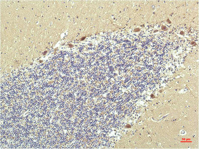 Anti-PPARD Monoclonal
