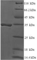 DAN domain family member 5 (DAND5), human, recombinant