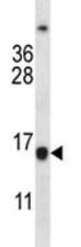 Anti-Bcl-2