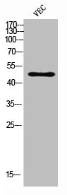Anti-CSF2RA