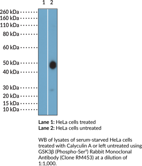 Anti-GSK3beta (Phospho-Ser9) Rabbit (Clone RM453