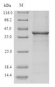 Thioredoxin domain-containing protein 17 (TXNDC17), human, recombinant