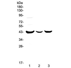 Anti-P2RY5 / P2Y Purinoceptor 5 / LPAR6