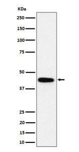 Anti-GALT / Galactose-1-phosphate uridylyltransferase, clone 29G81