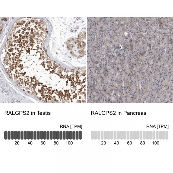 Anti-RALGPS2