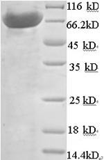 N-acetylmuramoyl-L-alanine amidase (PGLYRP2), human, recombinant