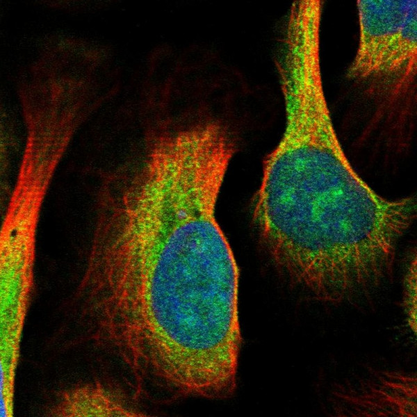 Anti-MDN1
