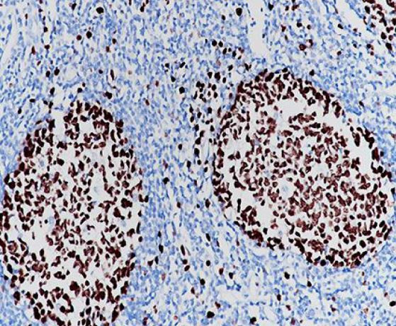 Anti-Ki-67, clone SQab1897