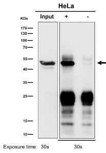 Anti-ACTR1B / Actin related protein 1B, clone 30A59