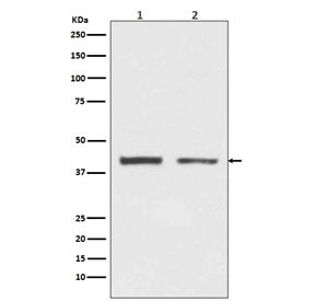 Anti-hnRNP C1/C2 / HNRNPC, clone FEB-8