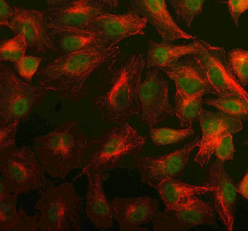 Anti-PSME4 / Proteasome activator complex subunit 4
