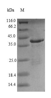 Renin receptor (ATP6AP2), human, recombinant