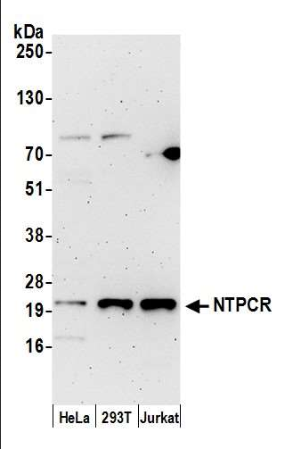 Anti-NTPCR