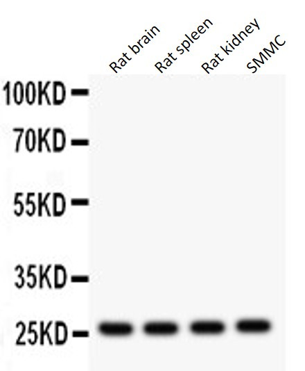 Anti-FLT3 Ligand