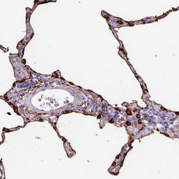Anti-SFTPA1