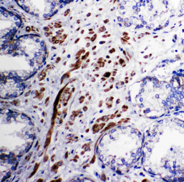 Anti-PDK1 / Mitochondrial Pyruvate Dehydrogenase Kinase 1