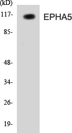 EPHA5 In-Cell ELISA