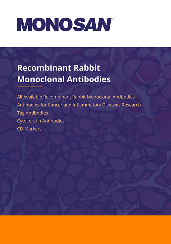 Recombinant Rabbit Monoclonal Antibodies