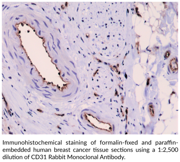 Anti-CD31 Rabbit Monoclonal Antibody (Clone RM247)