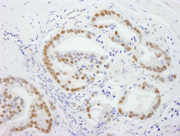 Anti-DDX5 (IHC)