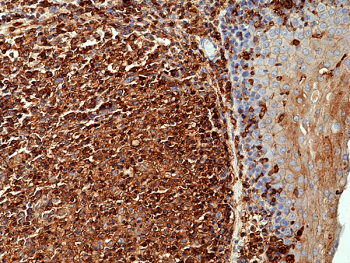 Anti-beta-Actin, Rabbit Monoclonal (RM112)