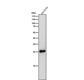 Anti-SNAP25 / Synaptosomal-associated protein 25 kDa, clone 32S42