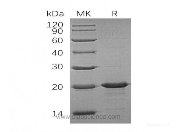 Interleukin-33/IL-33 Protein(N-6His) (recombinant human)