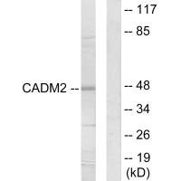 Anti-CADM2