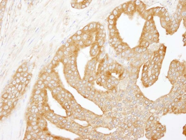 Anti-Coronin 2 (IHC)