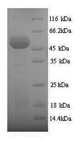 Sulfite oxidase, mitochondrial (SUOX), human, recombinant