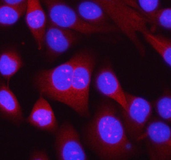 Anti-RPL14 / 60S ribosomal protein L14