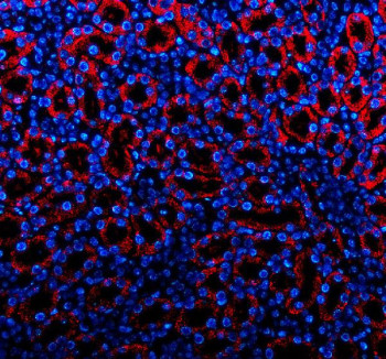 Anti-PDGFD / Platelet-derived growth factor D