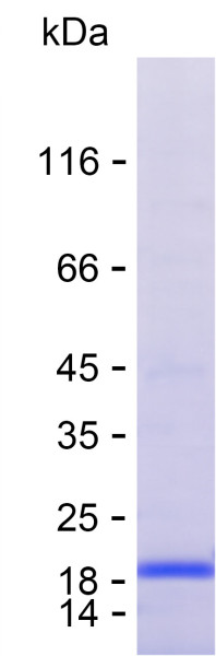 Recombinant Human ACSS1 Protein