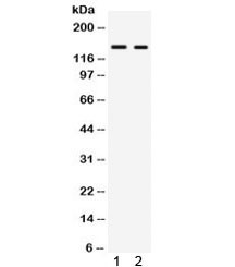 Anti-RIP140 / NRIP1