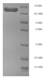 Phosphoglucomutase-1 (PGM1), human, recombinant