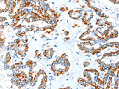Anti-ALDH5A1