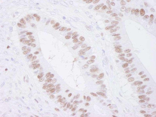 Anti-MCM3 (IHC)